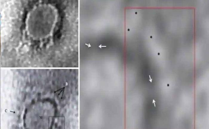 first image covid 19 virus