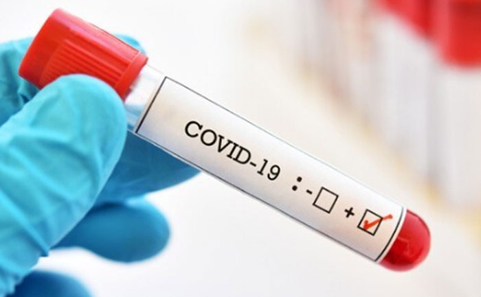 covid-19 blood