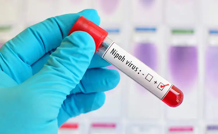 kerala nipah virus
